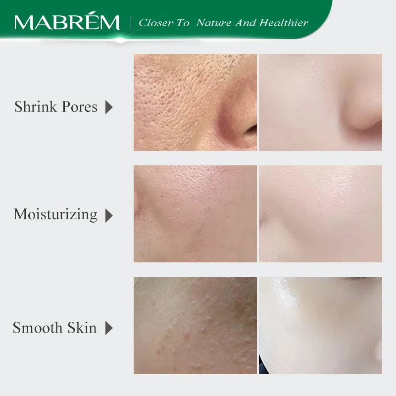 MABREM Pore Shrinking Serum Essence Pores Treatment Moisturizing Relieve Dryness Oil-Control Firming Repairing Smooth Skin Care