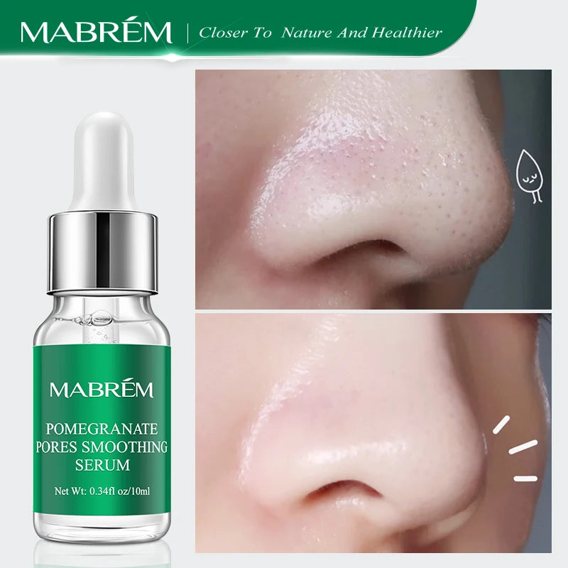 MABREM Pore Shrinking Serum Essence Pores Treatment Moisturizing Relieve Dryness Oil-Control Firming Repairing Smooth Skin Care